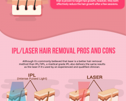 Pros-and-Cons-Laser-IPL-Hair-Removal