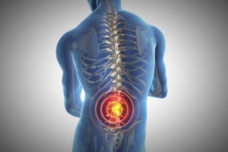 Back-bone-Pain-st