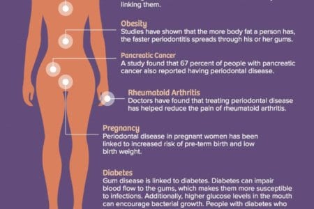 Health Connection Between Your Mouth And Body