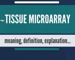 Tissue Microarray