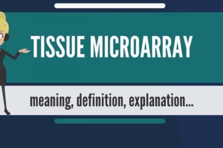 Tissue Microarray