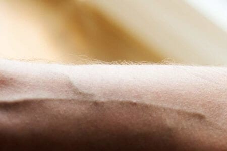 closeup-of-a-human-arm-and-vein