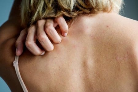 white-woman-back-pain-and-ache