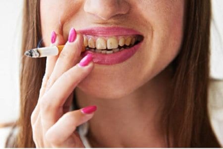 smoking-women-teeth