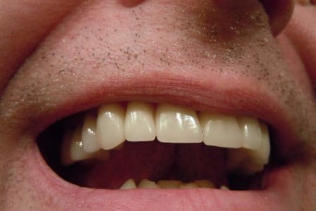 tooth-mouth-lips